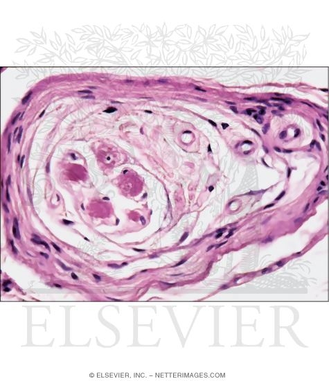 Light Micrograph of a Muscle Spindle In Transverse Section at Higher Magnification