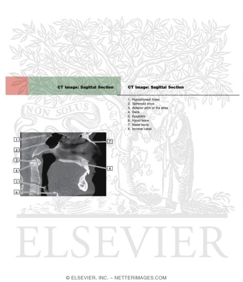 CT Image: Sagittal Section