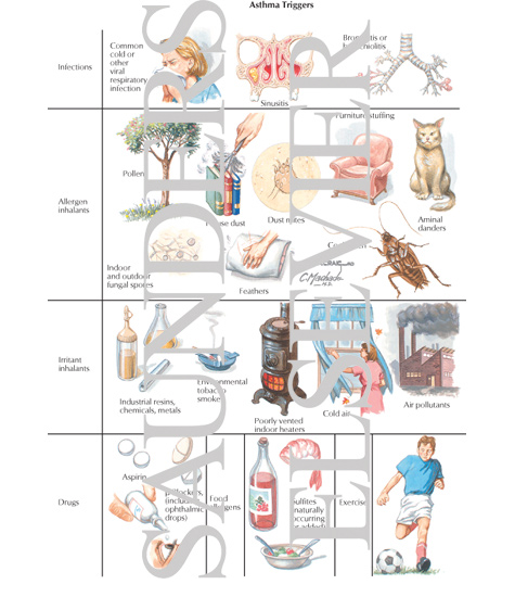 Asthma Triggers The preview images do not contain enough pixels to make Asthma Triggers The preview images do not contain enough pixels to make