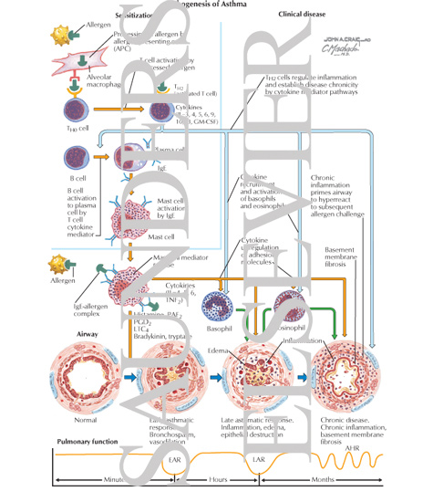 Pathogenesis of Asthma