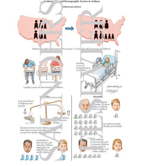 Epidemiology and Demographic Factors in Asthma