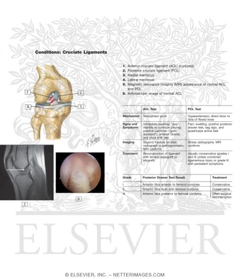 Conditions of the Cruciate Ligament (Hart Flash Cards 6-21)