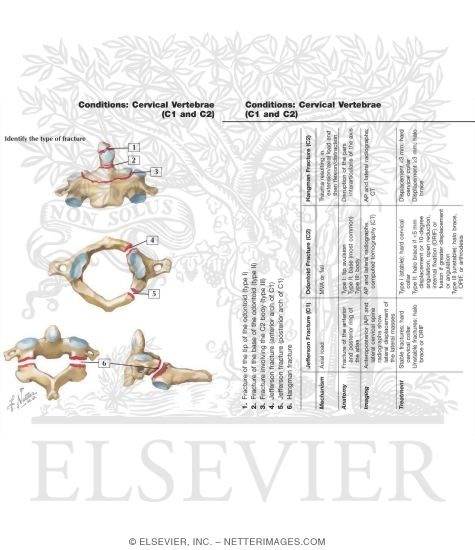 Conditions of the Cervical Vertebrae (C1 and C5) (Hart Flash Cards 3-25)