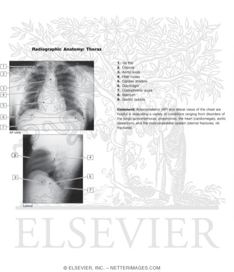 Radiographic Anatomy: Thorax