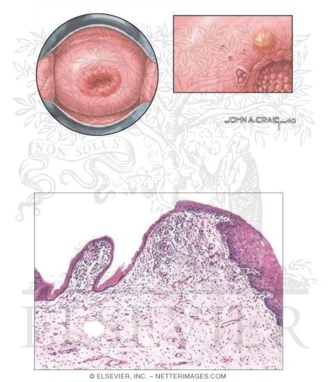 Uterine Cervix