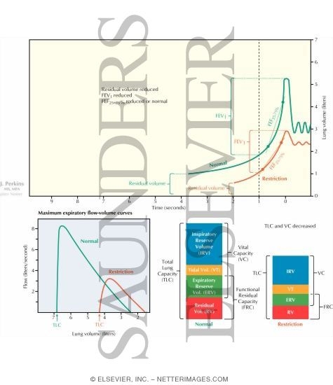 Restrictive Lung Disease Physiology