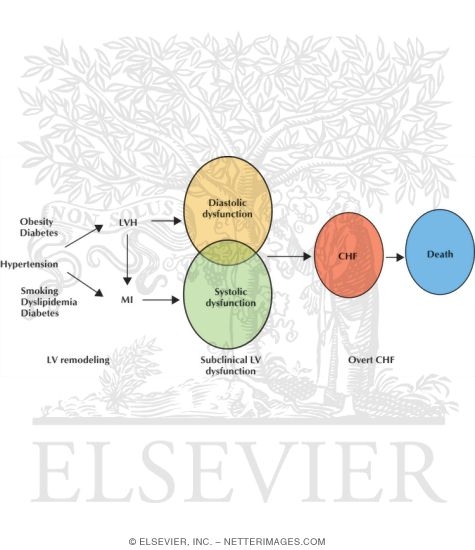 Testicular Failure: Seminiferous Tubular Dysgenesis (Klinefelter's Syndrome)
