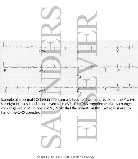Normal ECG