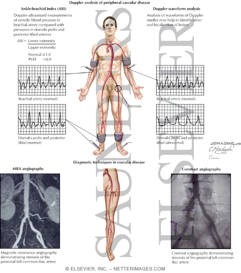 Peripheral Vascular Disease The preview images do not contain enough pixels 