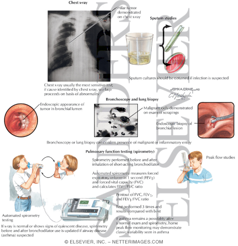 Diagnostic Testing In Chronic Cough