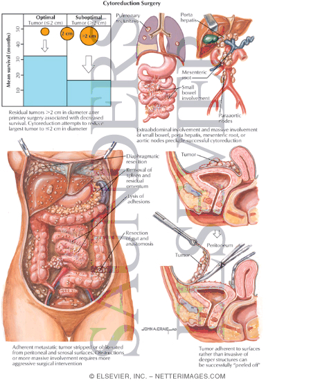 Free mobile app shortcut lГЎska je lГЎska 2011 discografia ska-p free