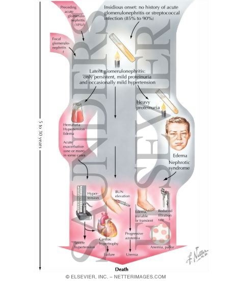 Clinical Course of Chronic Glomerulonephritis