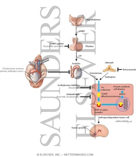 Androgen Deprivation In Metastatic Disease