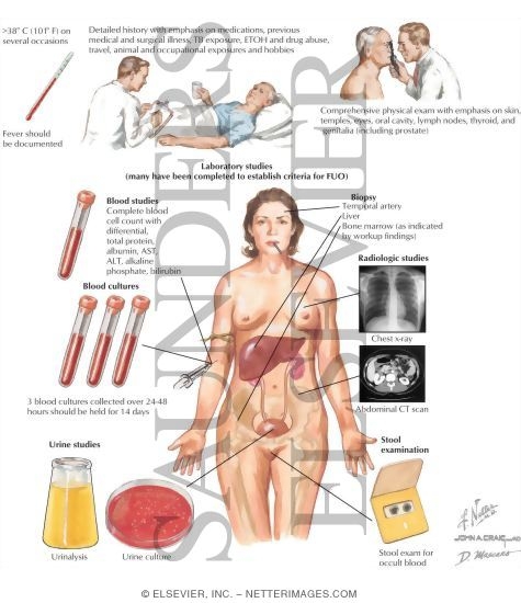 Diagnostic Consideratiosn In Fever of Unknown Origin