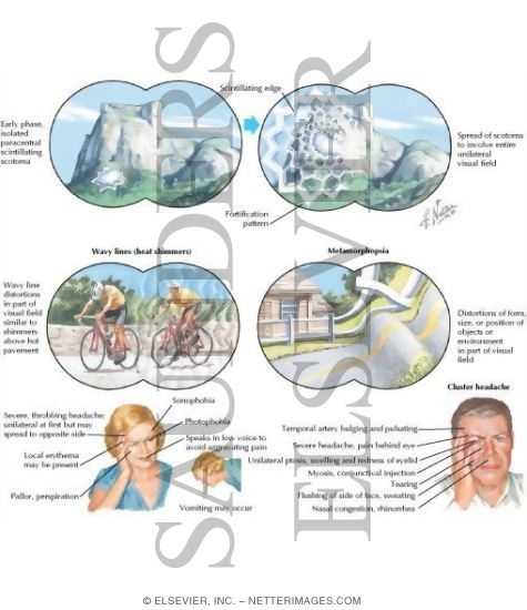 Migraine Prodromes and Attack