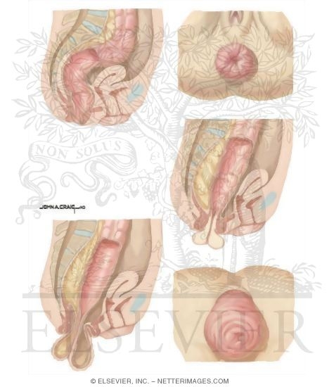 Fetish art pictures Alman anal sex hd