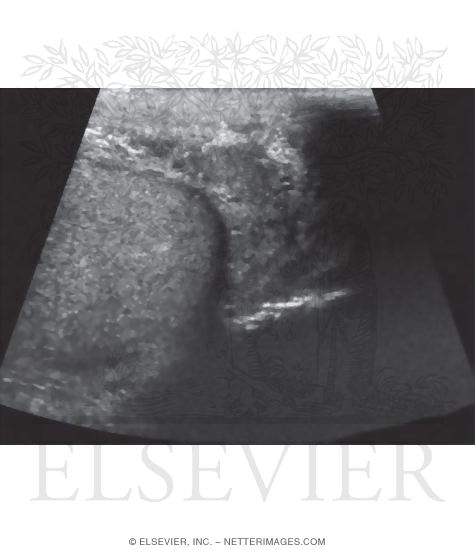 Testis and Epididymis