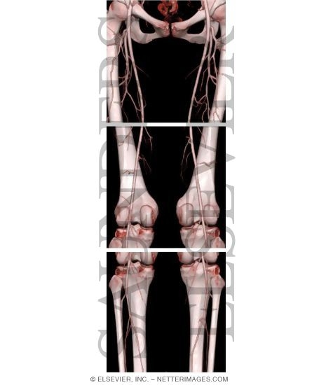 Arteries of the Lower Limb
