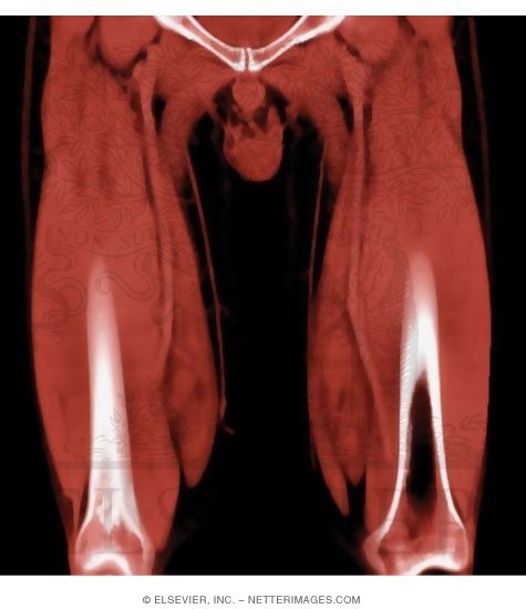 Deep Anterior Thigh Region