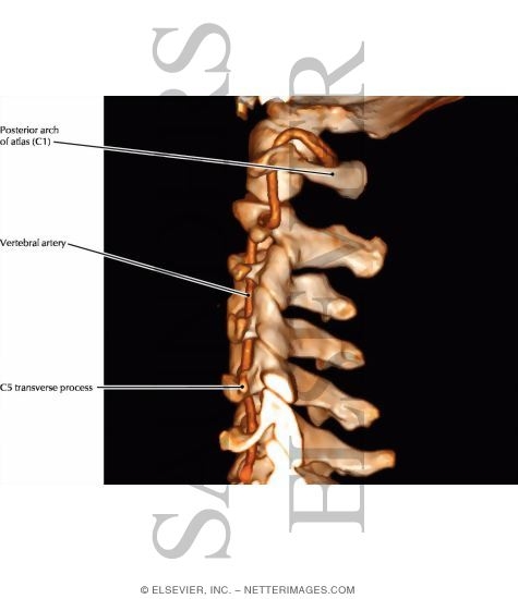 Vertebral Artery: Neck