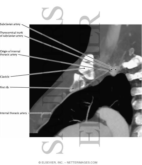 Right Subclavian Artery: Origin