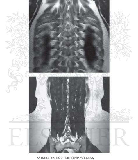 Deep Muscles of the Back