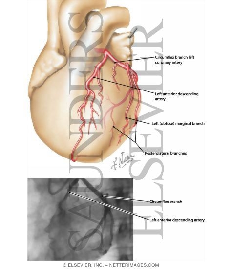 Coronary Vessels: Anterior View