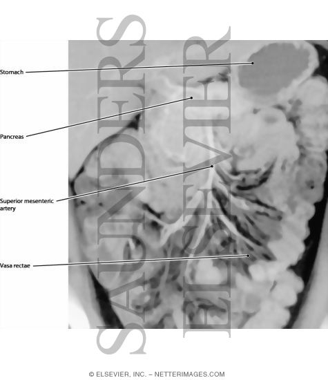 Arteries of the Small Bowel
