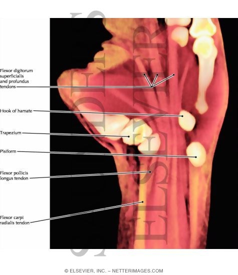 Flexor Muscles of the Wrist