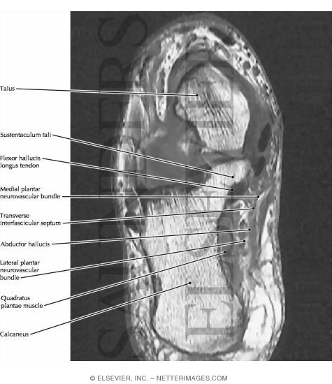 Tarsal Tunnel