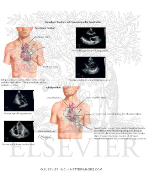 Echocardiography