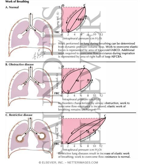 Work of Breathing