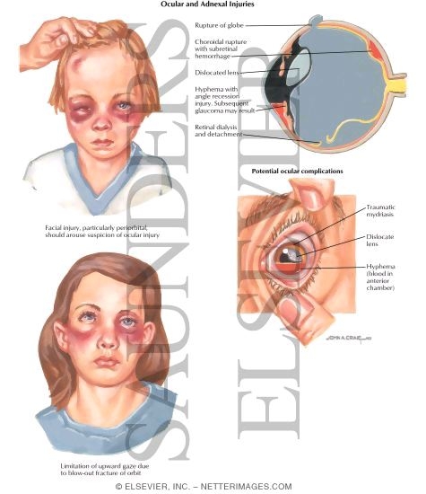 Child Abuse: Ocular and Adnexal Injuries