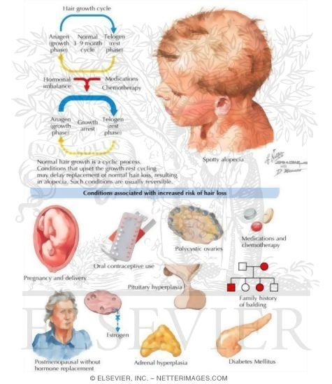 Hair Loss