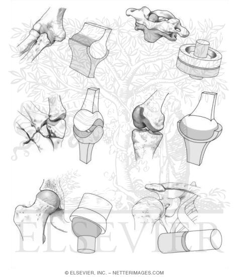 Synovial Joints