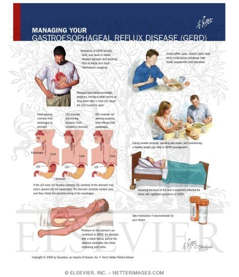 Managing Your Gastroesophageal Reflux Disease (GERD)
