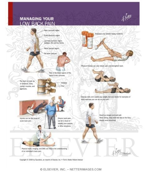 Managing Your Low Back Pain