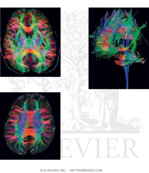 Diffusion Tensor Imaging. Diffusion Tensor Imaging