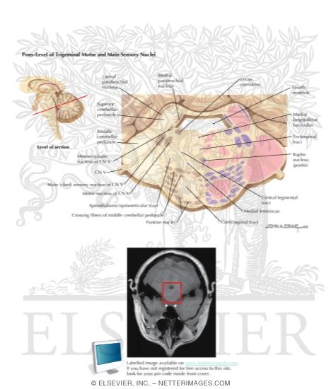 Brain Stem Cross-Sectional Anatomy: Section 9
