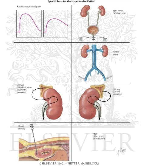 Special Tests for the Hypertensive Patient