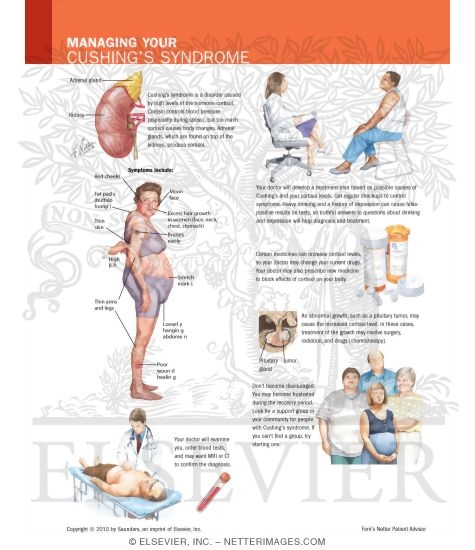 Syndrome De Cushing. Your Cushing#39;s Syndrome