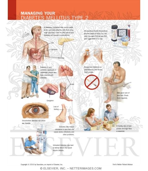 Managing Your Diabetes Mellitus Type 2