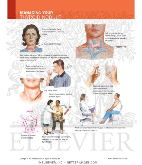 right thyroid nodule