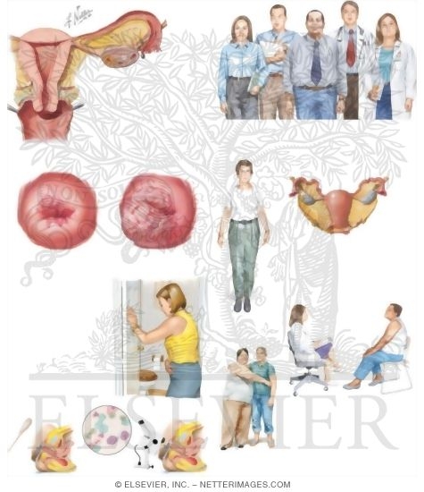 Managing Your Cervical Cancer