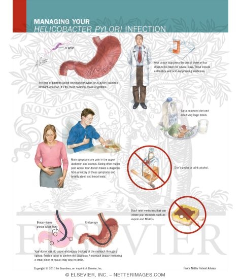Managing Your Helicobacter Pylori Infection