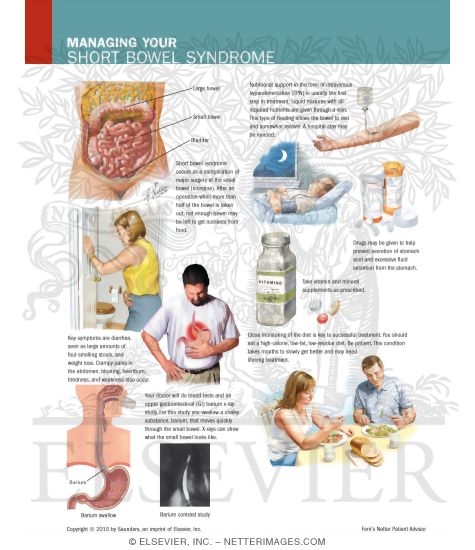 Managing Your Short Bowel Syndrome