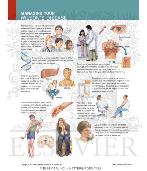 Managing Your Wilson's Disease