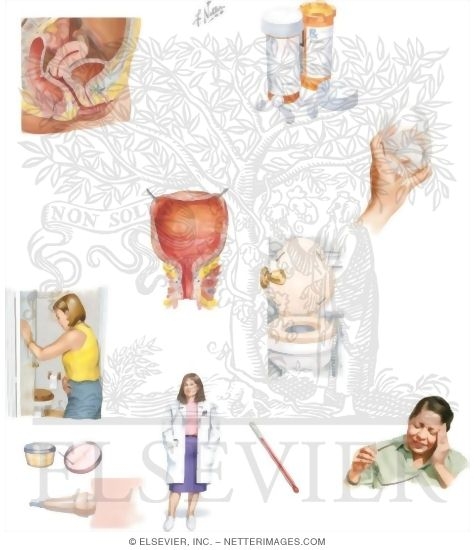 Managing Your Cystitis