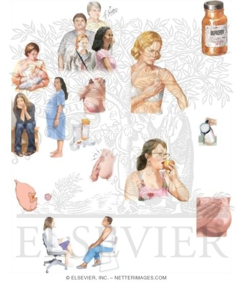 Managing Your Breast Pain