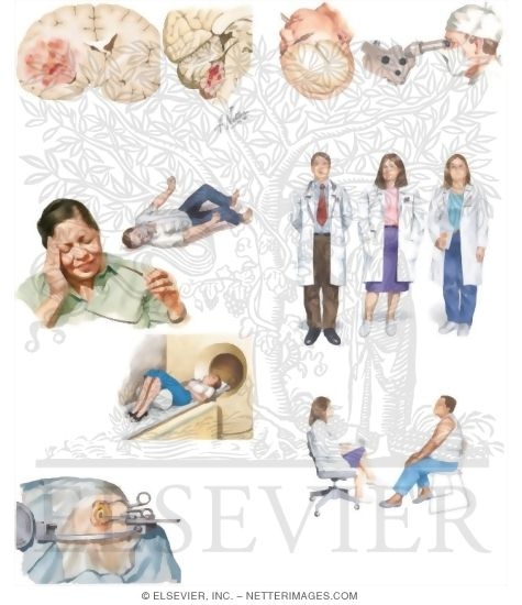 Managing Your Brain Cancer